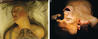 Illustration for article titled Wax anatomical figures are the stuff of nightmares